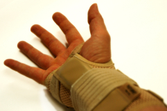 Hand With RSI In Splint
